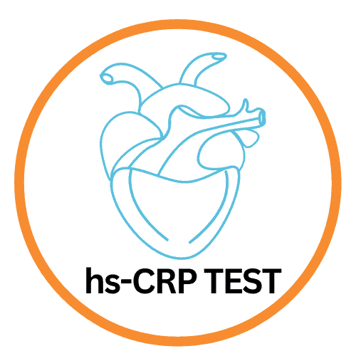 آزمایش ( HS – C-reactive protein ( HS CRP چیست و چگونه اندازه گیری می شود ؟